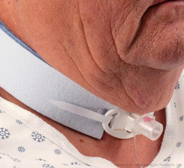 Tracheostomy Management Provider
